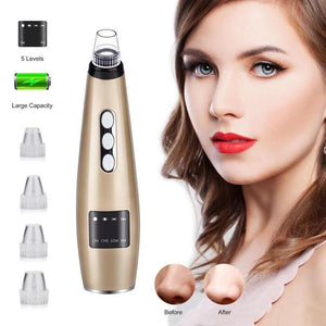 Pore Vacuum Blackhead Remover