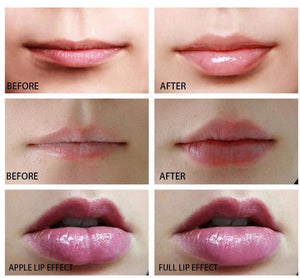 Electric Lip Plumper